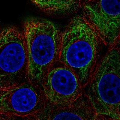 Immunocytochemistry/Immunofluorescence: Adenylate Cyclase 5 Antibody [NBP1-90279] - Staining of human cell line MCF7 shows localization to intermediate filaments.
