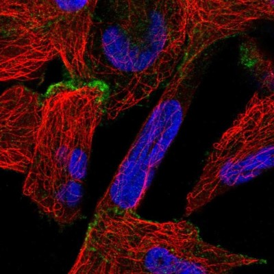 Immunocytochemistry/Immunofluorescence: OSBPL6 Antibody [NBP1-82475] - Staining of human cell line RH-30 shows localization to plasma membrane.