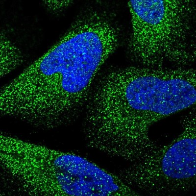 Immunocytochemistry/Immunofluorescence: GLIPR1L1 Antibody [NBP1-82722] - Staining of human cell line U-2 OS shows positivity in cytoplasm.