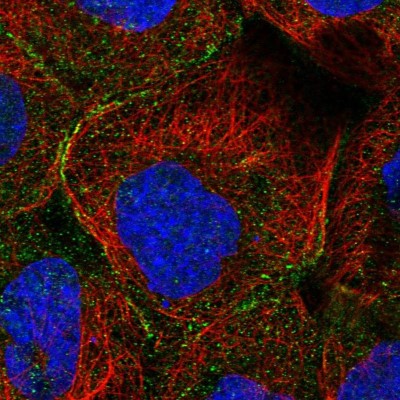 Immunocytochemistry/Immunofluorescence: MTHFSD Antibody [NBP1-82271] - Immunofluorescent staining of human cell line A-431 shows localization to vesicles.