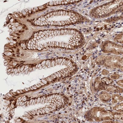 Immunohistochemistry-Paraffin: C16orf46 Antibody [NBP1-83527] - Staining of human stomach, lower shows strong nuclear positivity in glandular cells.