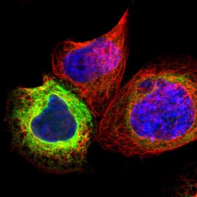 Immunocytochemistry/Immunofluorescence: SCD-1 Antibody [NBP1-84749] - Immunofluorescent staining of human cell line A-431 shows localization to endoplasmic reticulum.