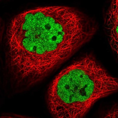 Immunocytochemistry/Immunofluorescence: APLF Antibody [NBP2-38212] - Immunofluorescent staining of human cell line A-431 shows localization to nucleoplasm.
