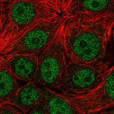 Immunocytochemistry/Immunofluorescence: NBEAL1 Antibody [NBP2-33553] - Immunofluorescent staining of human cell line MCF7 shows localization to nucleoplasm.