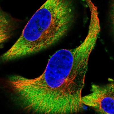 Immunocytochemistry/Immunofluorescence: LASS1 Antibody [NBP1-92067] - Staining of human cell line U-251 MG shows positivity in cytoplasm and centrosome.