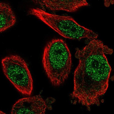 Immunocytochemistry/Immunofluorescence: FOG2 Antibody [NBP1-91909] - Immunofluorescent staining of human cell line PC-3 shows localization to nucleoplasm.