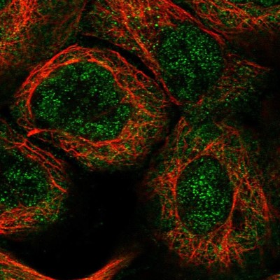 Immunocytochemistry/Immunofluorescence: PUS3 Antibody [NBP1-83885] - Staining of human cell line A-431 shows positivity in nucleus and cytoplasm.