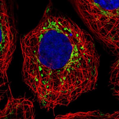 Immunocytochemistry/Immunofluorescence: GRPEL2 Antibody [NBP1-84174] - Immunofluorescent staining of human cell line A-431 shows localization to mitochondria.