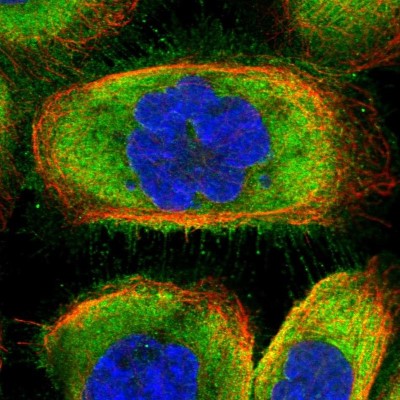 Immunocytochemistry/Immunofluorescence: CCDC124 Antibody [NBP2-48746] - Immunofluorescent staining of human cell line A-431 shows localization to plasma membrane & cytosol.