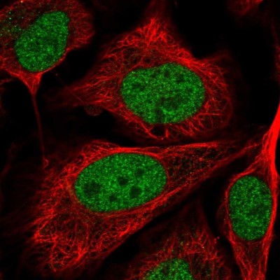 Immunocytochemistry/Immunofluorescence: C5orf24 Antibody [NBP2-31686] - Staining of human cell line U-2 OS shows localization to nucleoplasm.