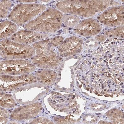 Immunohistochemistry-Paraffin: C5orf24 Antibody [NBP2-31686] - Staining of human kidney shows moderate cytoplasmic and nuclear positivity in renal tubules.