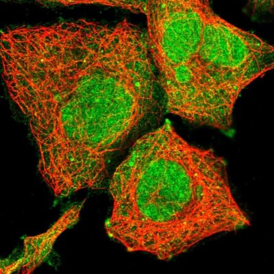 Immunocytochemistry/Immunofluorescence: FBRSL1 Antibody [NBP2-14695] - Staining of human cell line HEK 293 shows localization to nucleus, plasma membrane & cytosol.