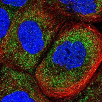 Immunocytochemistry/Immunofluorescence: lin-54 Antibody [NBP2-33794] - Immunofluorescent staining of human cell line A-431 shows localization to cytosol.