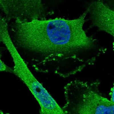 Immunocytochemistry/Immunofluorescence: Piccolo Antibody [NBP1-90250] - Staining of human cell line U-251 MG shows localization to nuclear speckles & plasma membrane.