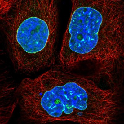 Immunocytochemistry/Immunofluorescence: Lamin B2 Antibody [NBP2-49368] - Immunofluorescent staining of human cell line A-431 shows localization to nuclear membrane.