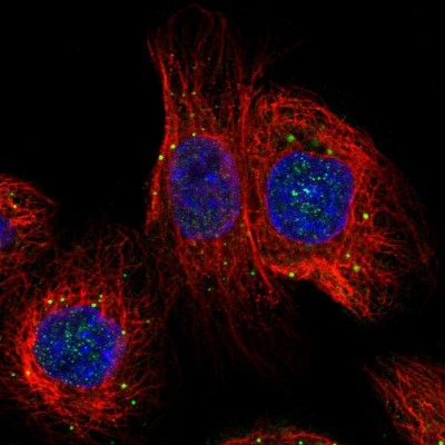 Immunocytochemistry/Immunofluorescence: C14orf166B Antibody [NBP1-86311] - Staining  of human cell line A-431 shows positivity in vesicles.