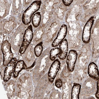 Immunohistochemistry-Paraffin: C14orf166B Antibody [NBP1-86311] - Staining of human kidney shows strong cytoplasmic and membranous positivity in subsets of tubules.