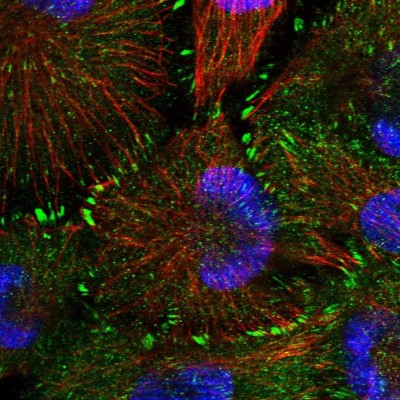 Immunocytochemistry/Immunofluorescence: CARD6 Antibody [NBP1-85613] - Immunofluorescent staining of human cell line U-251 MG shows localization to cytosol & focal adhesion sites.