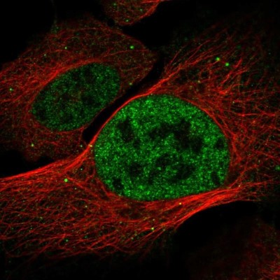 Immunocytochemistry/Immunofluorescence: DISP2 Antibody [NBP2-32498] - Staining of human cell line U-2 OS shows localization to nucleoplasm & vesicles.