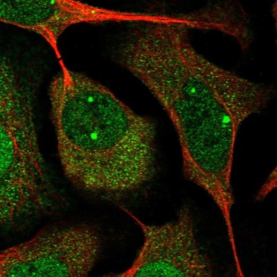 Immunocytochemistry/Immunofluorescence: Cyclin I Antibody [NBP2-34060] - Staining of human cell line U-2 OS shows localization to nucleoplasm, nuclear bodies & cytosol.