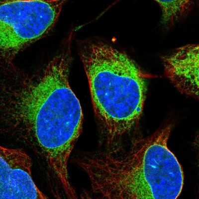 Immunocytochemistry/Immunofluorescence: ELOVL5 Antibody [NBP2-33500] - Immunofluorescent staining of human cell line U-2 OS shows localization to endoplasmic reticulum.
