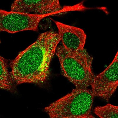 Immunocytochemistry/Immunofluorescence: UGT3A2 Antibody [NBP2-32468] - Staining of human cell line SH-SY5Y shows localization to nucleus, cytosol & the Golgi apparatus.