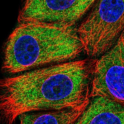 Immunocytochemistry/Immunofluorescence: EPS8L1 Antibody [NBP2-33288] - Immunofluorescent staining of human cell line MCF7 shows localization to cytosol.