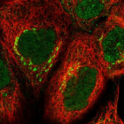 Immunocytochemistry/Immunofluorescence: OSBP1 Antibody [NBP2-47342] - Immunofluorescent staining of human cell line A-431 shows localization to nucleus & the Golgi apparatus.