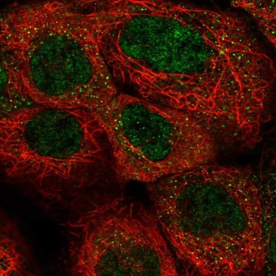 Immunocytochemistry/Immunofluorescence: NRK1 Antibody [NBP2-14426] - Staining of human cell line A-431 shows positivity in cytoplasm & nucleus but excluded from the nucleoli.