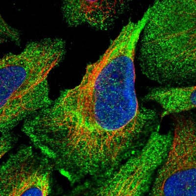 Immunocytochemistry/Immunofluorescence: Calpain 13 Antibody [NBP2-14435] - Staining of human cell line U-2 OS shows positivity in cytoplasm.