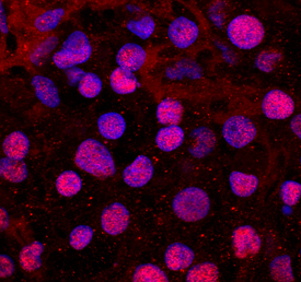 TBX20 was detected in immersion fixed BG01V human embryonic stem cells differentiated to cardiac cells using Mouse Anti-Human TBX20 Monoclonal Antibody (Catalog # MAB8124) at 10 µg/mL for 3 hours at room temperature. Cells were stained using the NorthernLights™ 557-conjugated Anti-Mouse IgG Secondary Antibody (red; Catalog # NL007) and counterstained with DAPI (blue). Specific staining was localized to nuclei. View our protocol for Fluorescent ICC Staining of Stem Cells on Coverslips.