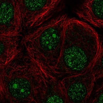 Immunocytochemistry/Immunofluorescence: FBXO36 Antibody [NBP2-56087] - Staining of human cell line MCF7 shows localization to nucleus & nucleoli.