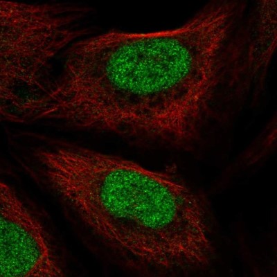 Immunocytochemistry/Immunofluorescence: PHAX Antibody [NBP2-55912] - Staining of human cell line U-2 OS shows localization to nucleus.
