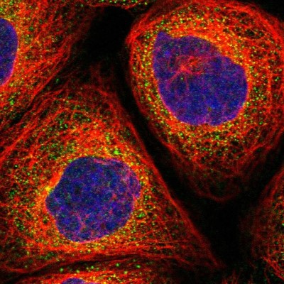 Immunocytochemistry/Immunofluorescence: FAM185A Antibody [NBP1-93479] - Immunofluorescent staining of human cell line A-431 shows localization to cytosol.