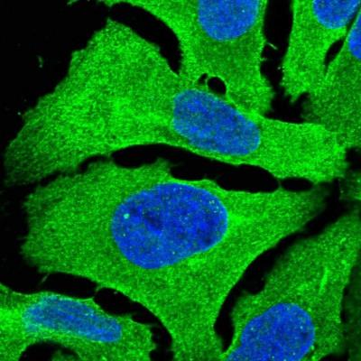 Immunocytochemistry/ Immunofluorescence: EXOC3L1 Antibody [NBP1-90471] - Staining of human cell line U-2 OS shows positivity in plasma membrane, cytoplasm and cytoskeleton (microtubules).