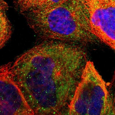 Immunocytochemistry/Immunofluorescence: FRMPD3 Antibody [NBP1-93573] - Staining of human cell line A-431 shows positivity in cytoplasm.