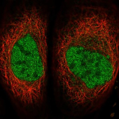 Immunocytochemistry/Immunofluorescence: SERTAD4 Antibody [NBP1-84216] - Immunofluorescent staining of human cell line A-431 shows localization to nucleoplasm.