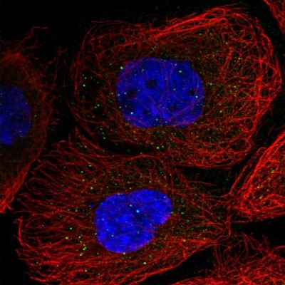 Immunocytochemistry/Immunofluorescence: TLX2 Antibody [NBP1-83973] - Staining of human cell line A-431 shows no positivity.