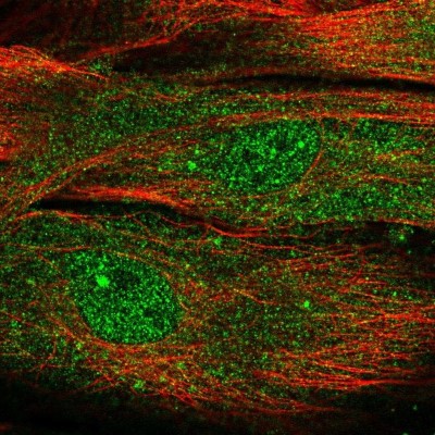 Immunocytochemistry/Immunofluorescence: MOXD1 Antibody [NBP1-84233] - Staining of human cell line BJ shows localization to nucleoplasm & cytosol.