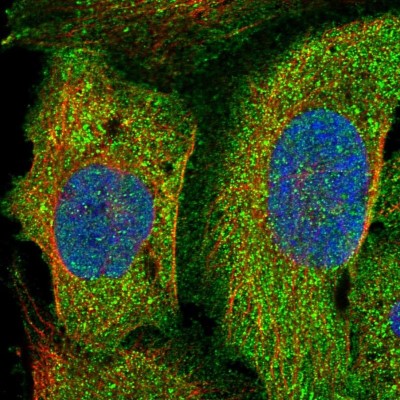 Immunocytochemistry/Immunofluorescence: PLEKHO2 Antibody [NBP1-84101] - Immunofluorescent staining of human cell line U-2 OS shows localization to plasma membrane & cytosol.