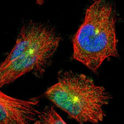Immunocytochemistry/Immunofluorescence: SLC31A1/CTR1 Antibody [NBP1-84405] - Staining of human cell line U-251MG shows positivity in nucleus but not nucleoli and centrosome.