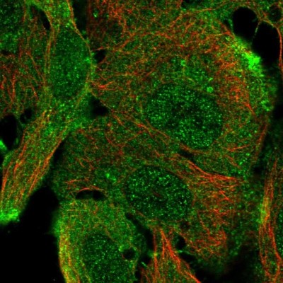 Immunocytochemistry/Immunofluorescence: ARAP1 Antibody [NBP2-56429] - Staining of human cell line HaCaT shows localization to nucleoplasm & plasma membrane.