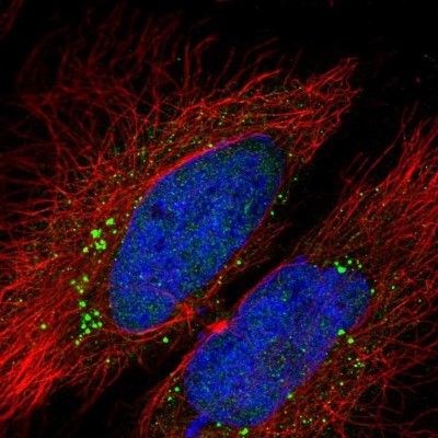 Immunocytochemistry/Immunofluorescence: LCMT2 Antibody [NBP2-56384] - Staining of human cell line HeLa shows localization to nucleoplasm & vesicles.