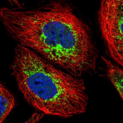 Immunocytochemistry/Immunofluorescence: ACAD9 Antibody [NBP2-56718] - Staining of human cell line A-431 shows localization to mitochondria.