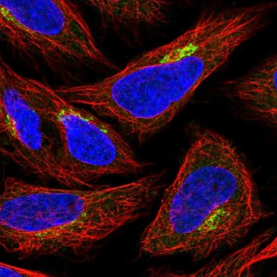 Immunocytochemistry/Immunofluorescence: GPR108 Antibody [NBP2-56970] - Staining of human cell line SiHa shows localization to the Golgi apparatus.