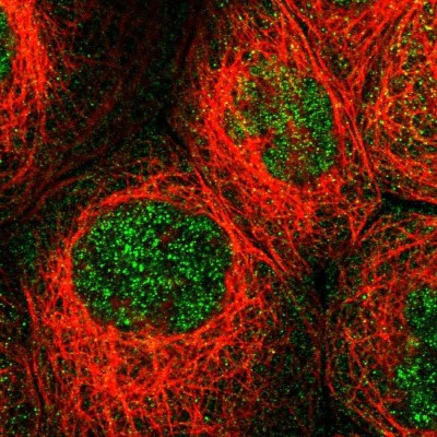 Immunocytochemistry/Immunofluorescence: MFSD6 Antibody [NBP1-82203] - Immunofluorescent staining of human cell line A-431 shows localization to nucleoplasm & cytosol.