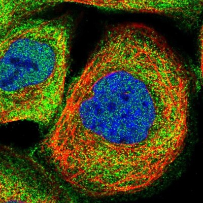 Immunocytochemistry/Immunofluorescence: MAS1L Antibody [NBP1-85157] - Immunofluorescent staining of human cell line A-431 shows localization to nucleoplasm, plasma membrane & cytosol.