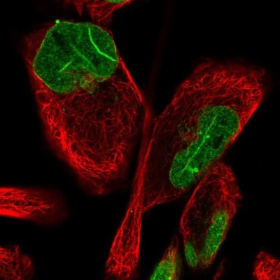 Immunocytochemistry/Immunofluorescence: FAM135B Antibody [NBP1-86717] - Immunofluorescent staining of human cell line RH-30 shows localization to nucleoplasm & nuclear membrane.