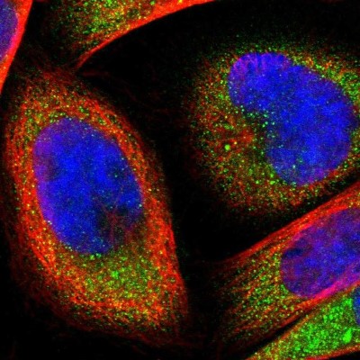 Immunocytochemistry/Immunofluorescence: FTSJ1 Antibody [NBP1-85703] - Immunofluorescent staining of human cell line A-431 shows localization to cytosol.