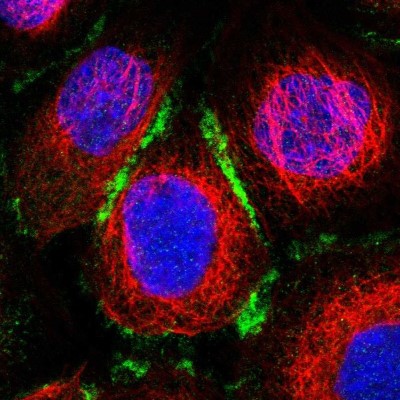 Immunocytochemistry/Immunofluorescence: ELMO3 Antibody [NBP1-85695] - Immunofluorescent staining of human cell line A-431 shows localization to plasma membrane & cell junctions.
